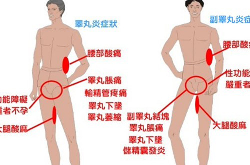 检查睾丸炎常用方法