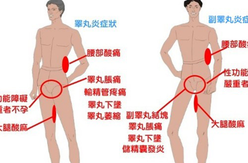 睾丸表皮瘙痒是什么原因?揭秘