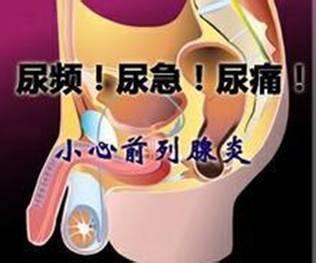 【图】前列腺炎的症状表现有哪些？【四种方法消除症状】