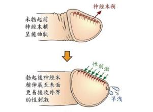 早泄治疗方法大全【早泄治疗技术的4大优势】