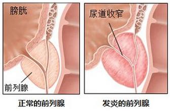 前列腺在什么位置图片【四个前列腺功能必知】