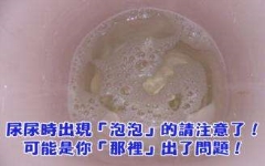 小便泡沬多且难消失是什么原因？该怎么办？