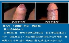 包皮手术后伤口愈合图片「图」如何愈合？