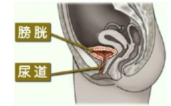 膀胱炎症状有哪些？和尿道炎有哪些区别？