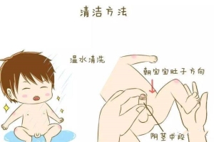 小孩有包皮垢怎么办?劳永逸的方法你知道吗?